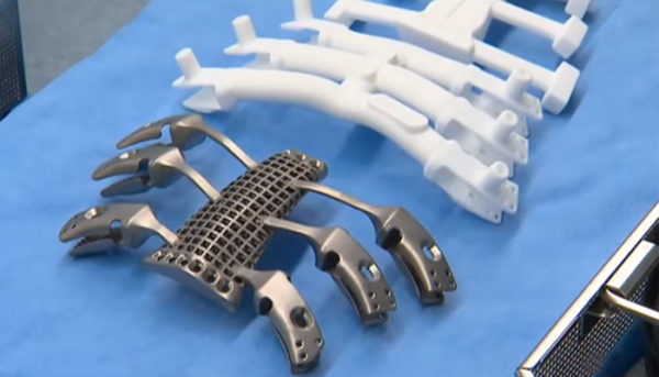 Unsw Scientists Use New Bioink To Create 3d Printed Bone 3dnatives