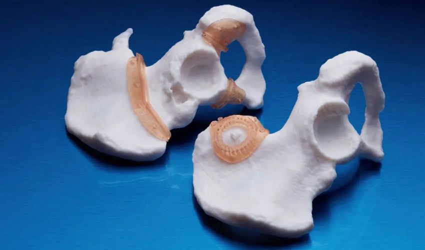 Ricoh and Insight Surgery Collaborate to Create 3D Printed Surgical Guides