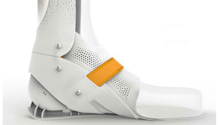 TOP 12 3D Printed Orthoses - 3Dnatives