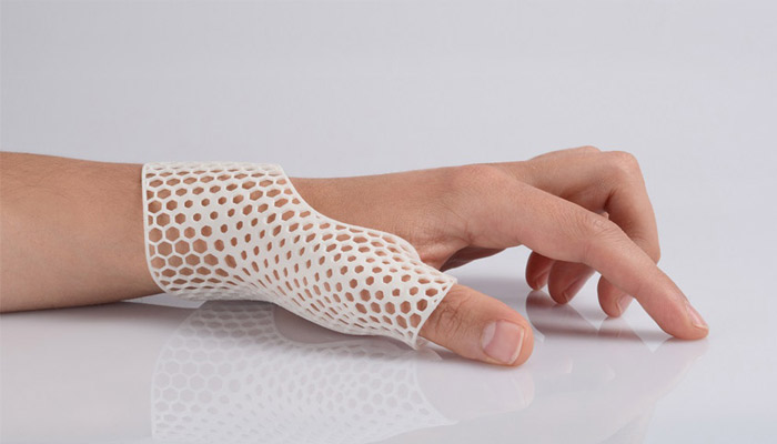 3d printed orthotics price