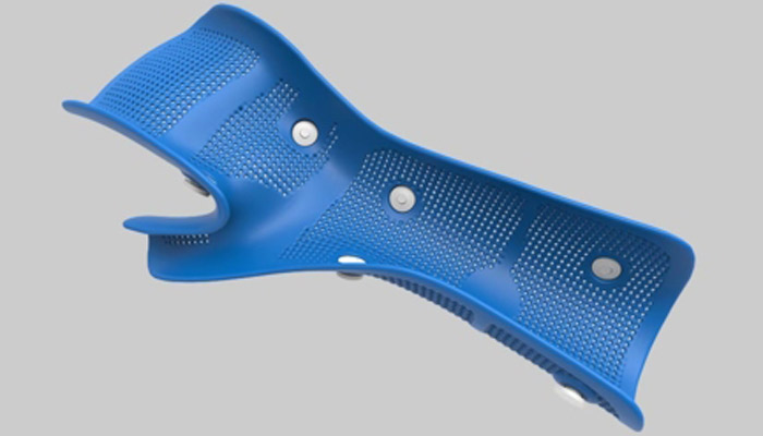 TOP 12 3D Printed Orthoses - 3Dnatives