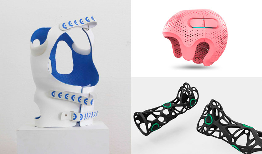 Orthèses imprimées en 3D : notre sélection de projets - 3Dnatives