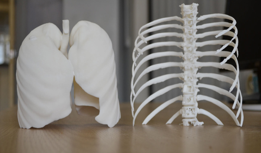 L'avenir de l'impression 3D dans le secteur de la santé - Le blog